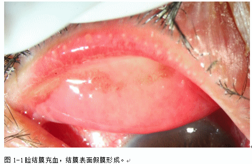 ZY016_2_2.gif